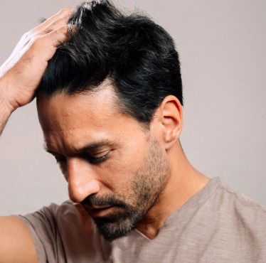 Greffe de cheveux – FUE