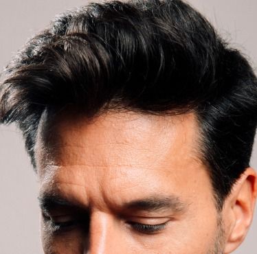 QUELS SONT LES TRAITEMENTS ANTI-CALVITIE POSSIBLES ?