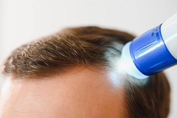 photobiomodulation_led_et_cheveux_efficacite_prouvee_ou_effet_de_mode