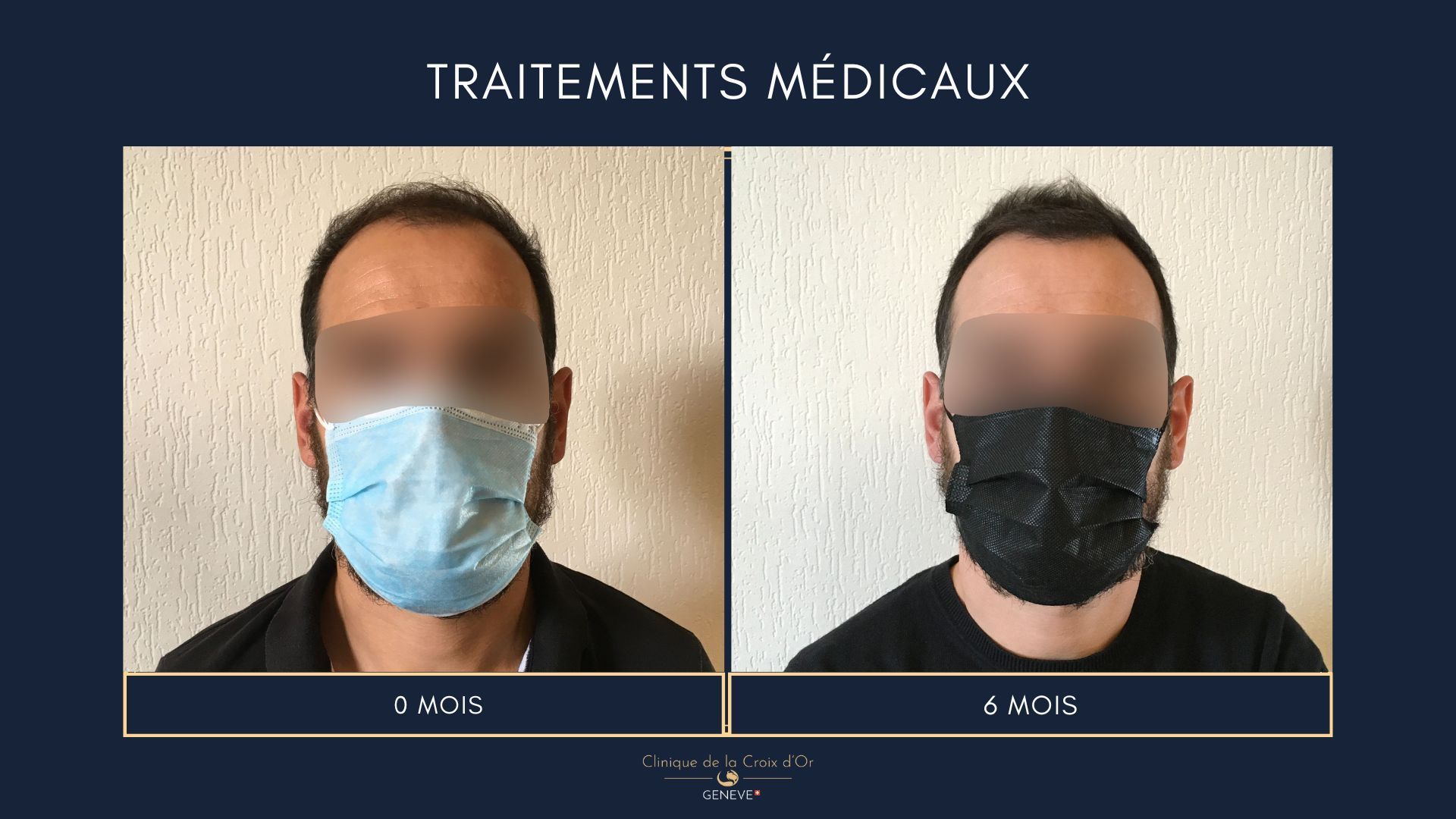 Medical treatments