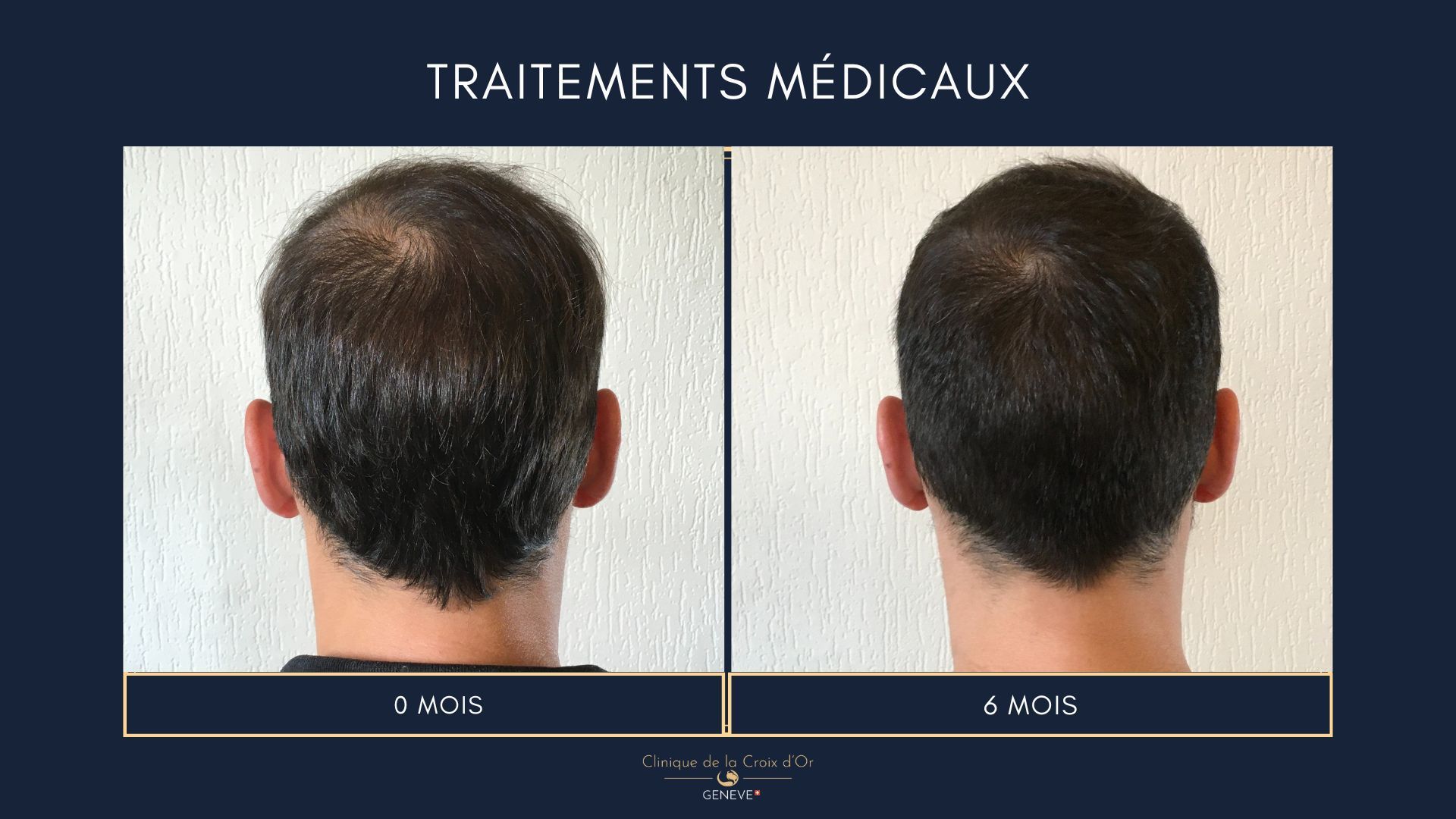 Medical treatments