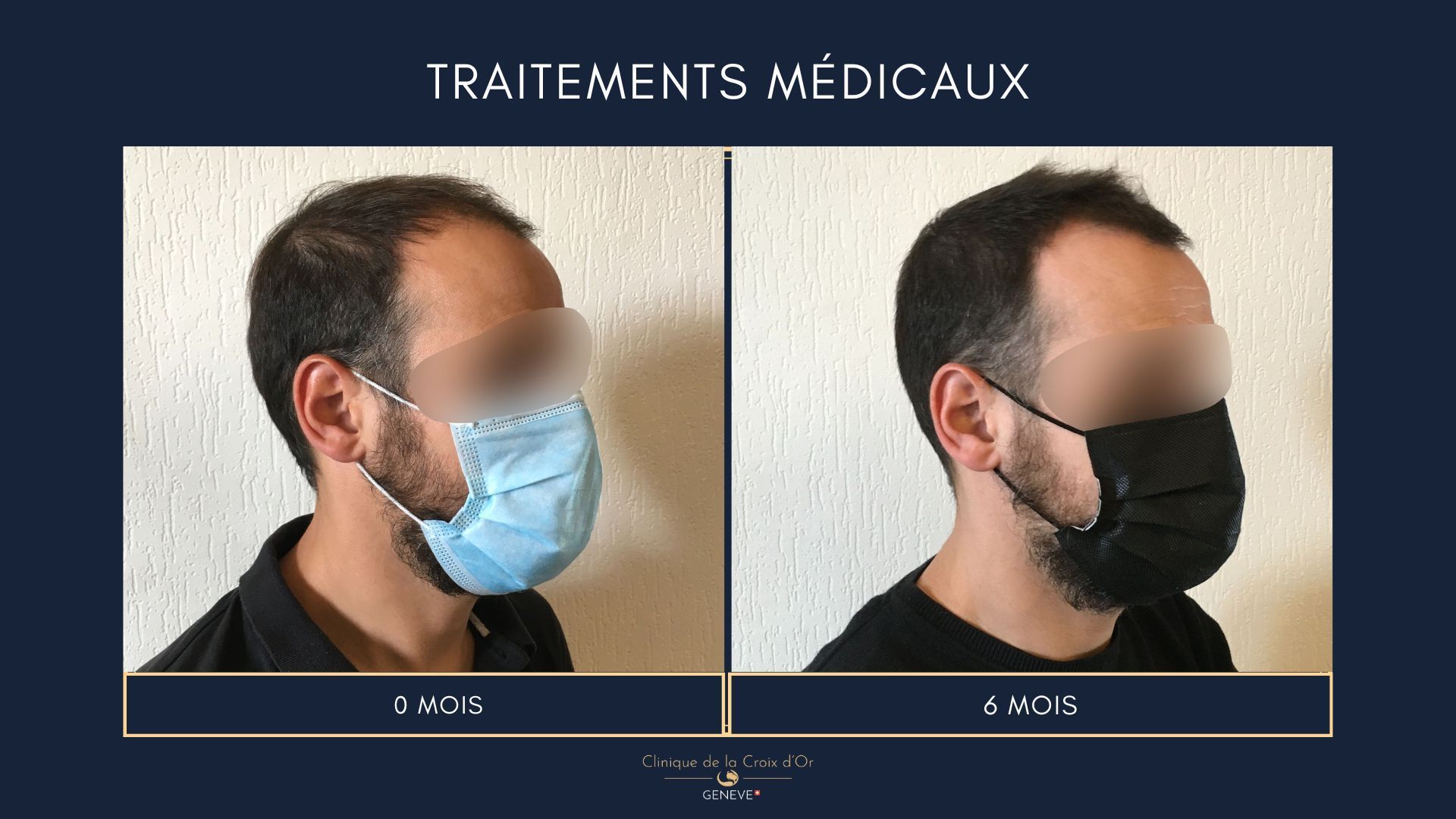 Medical treatments