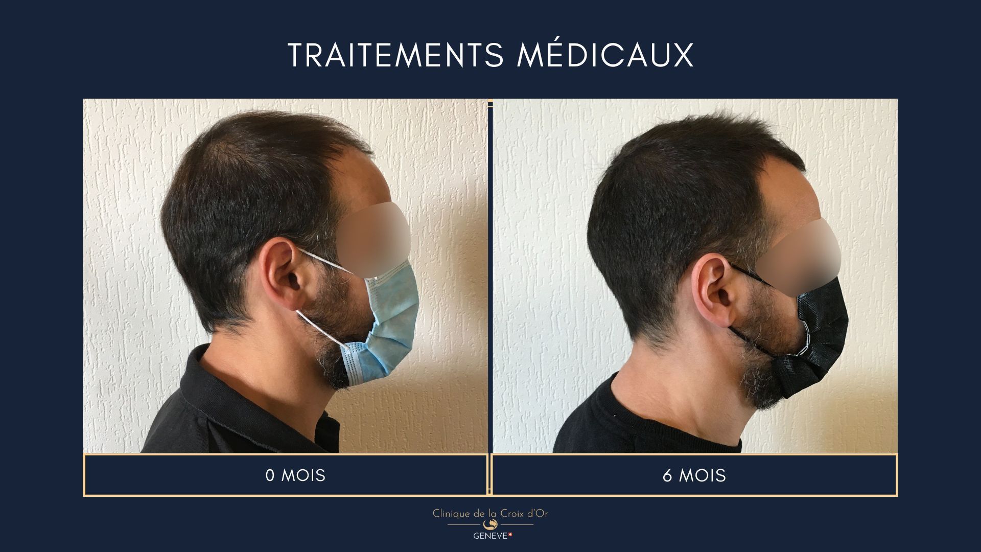 Medical treatments
