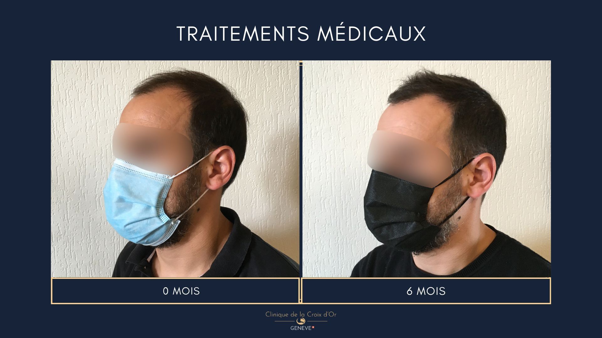 Medical treatments