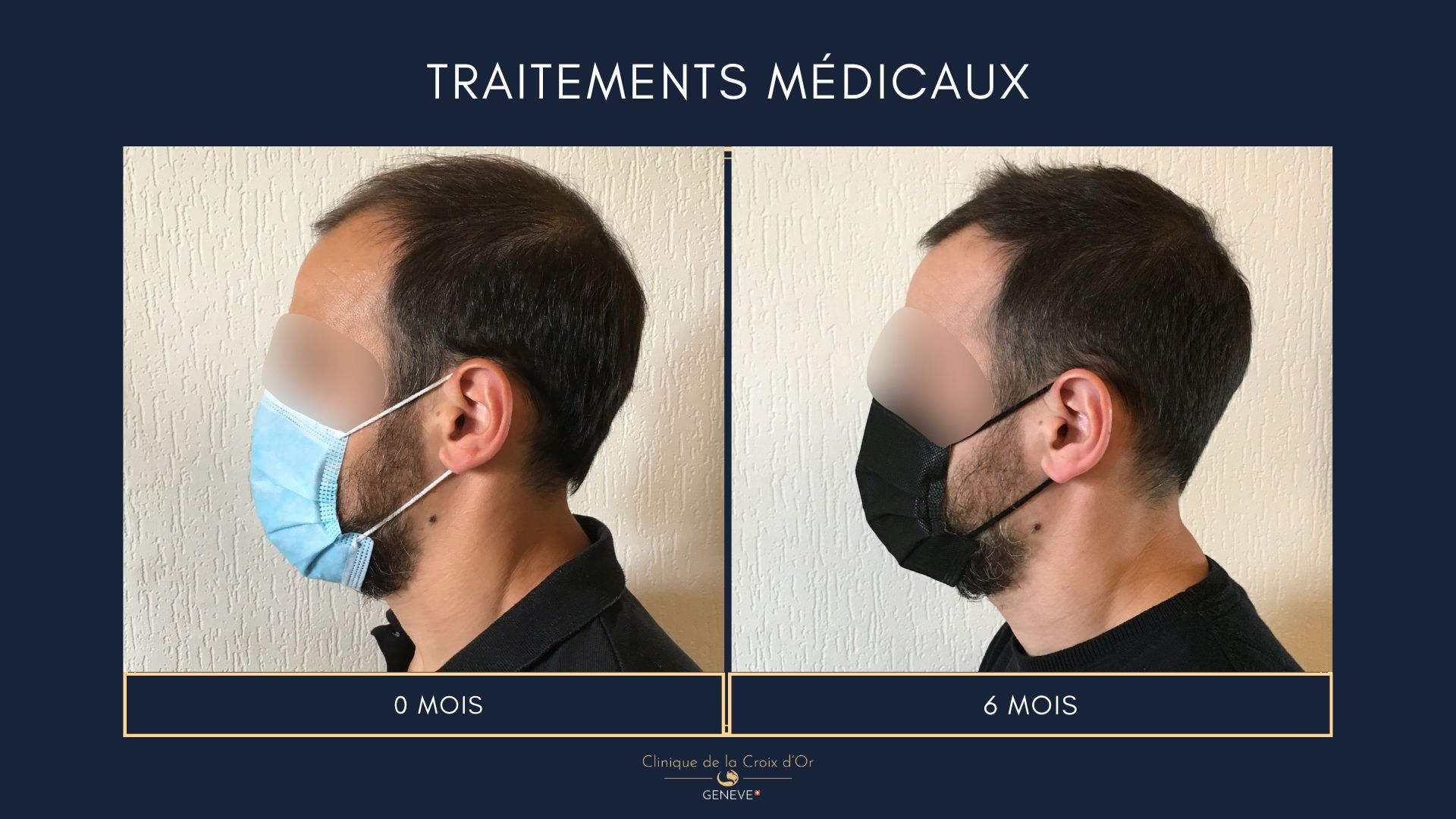 Medical treatments