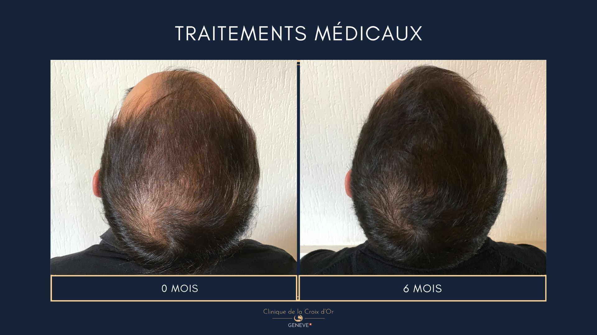 Medical treatments