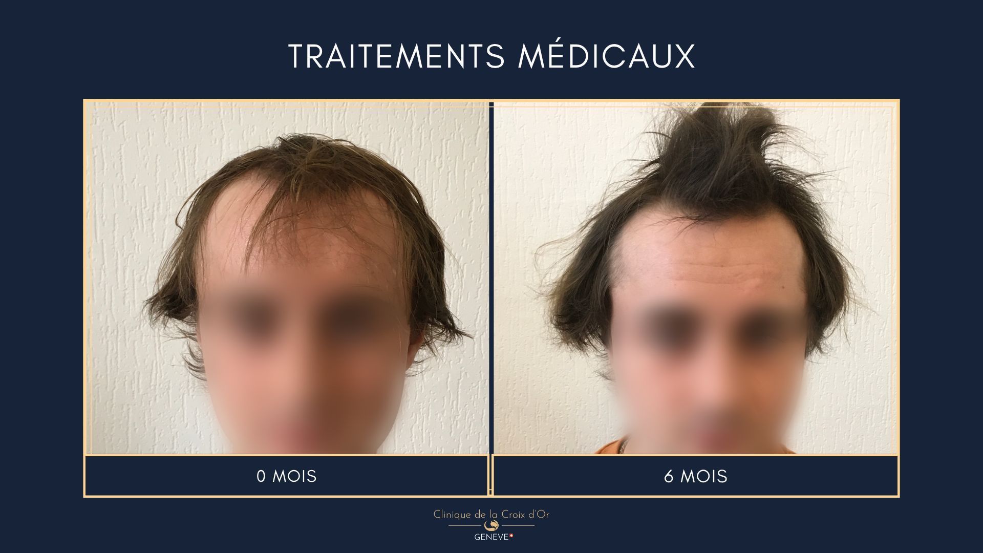 Medical treatments
