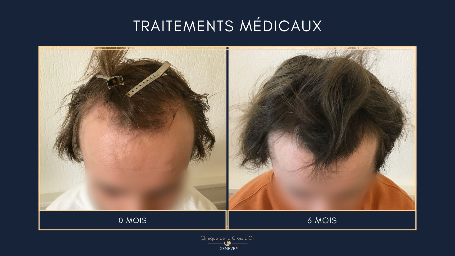 Medical treatments