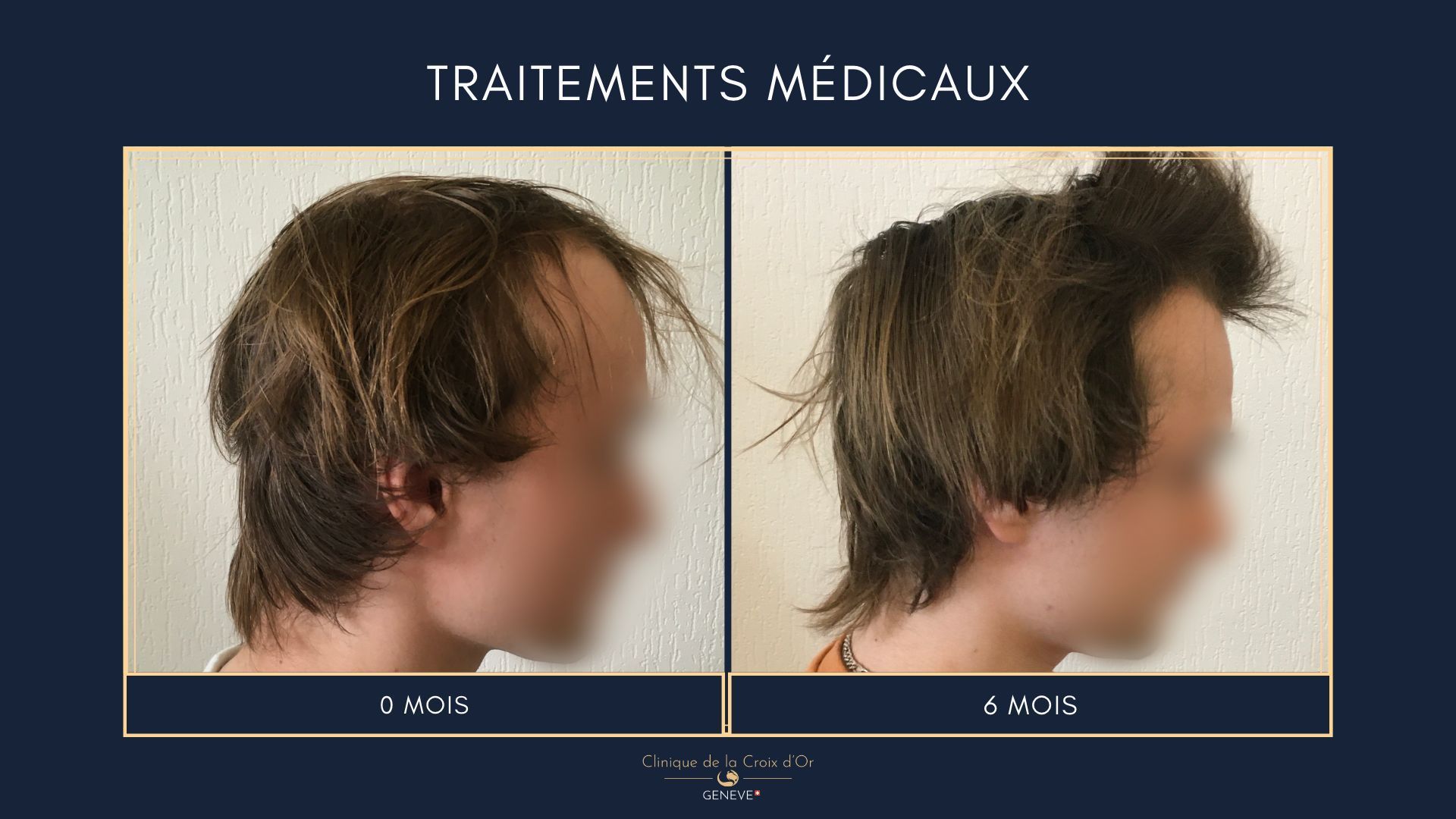 Medical treatments