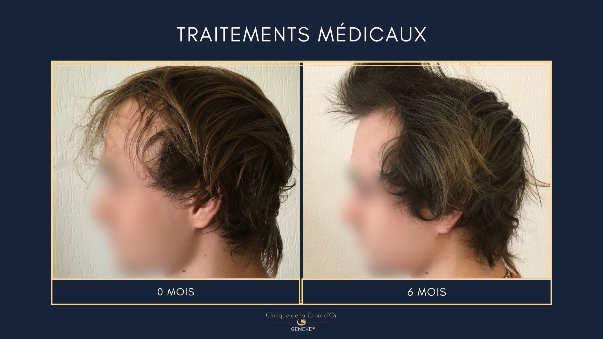 Medical treatments