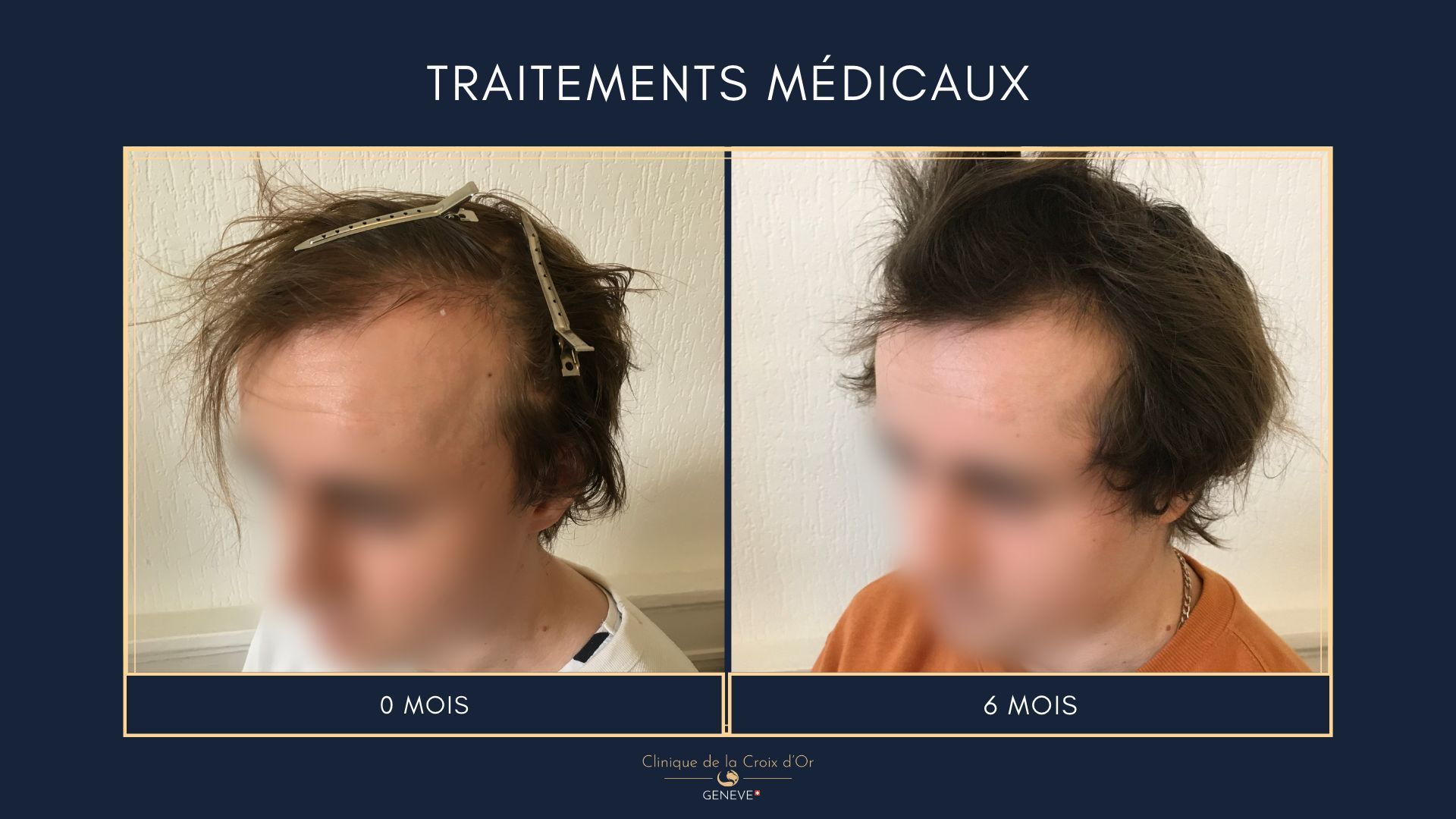 Medical treatments