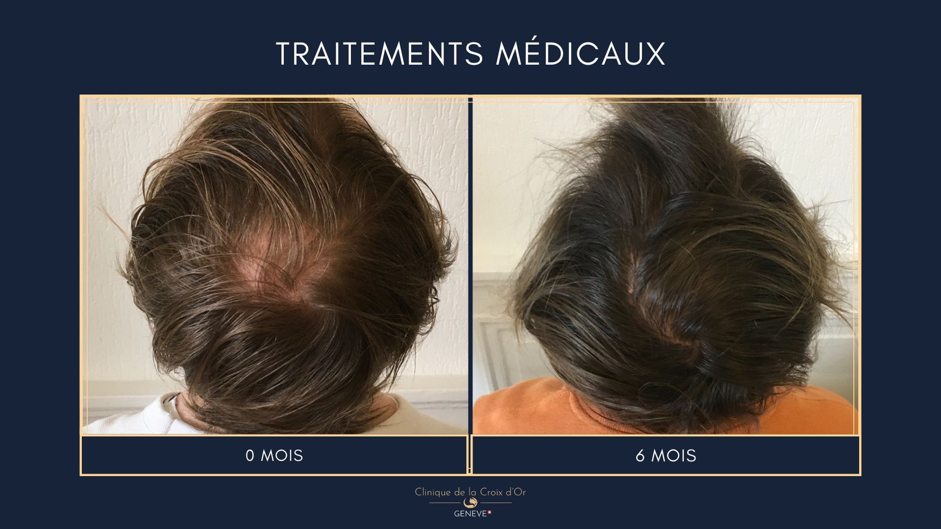Medical treatments
