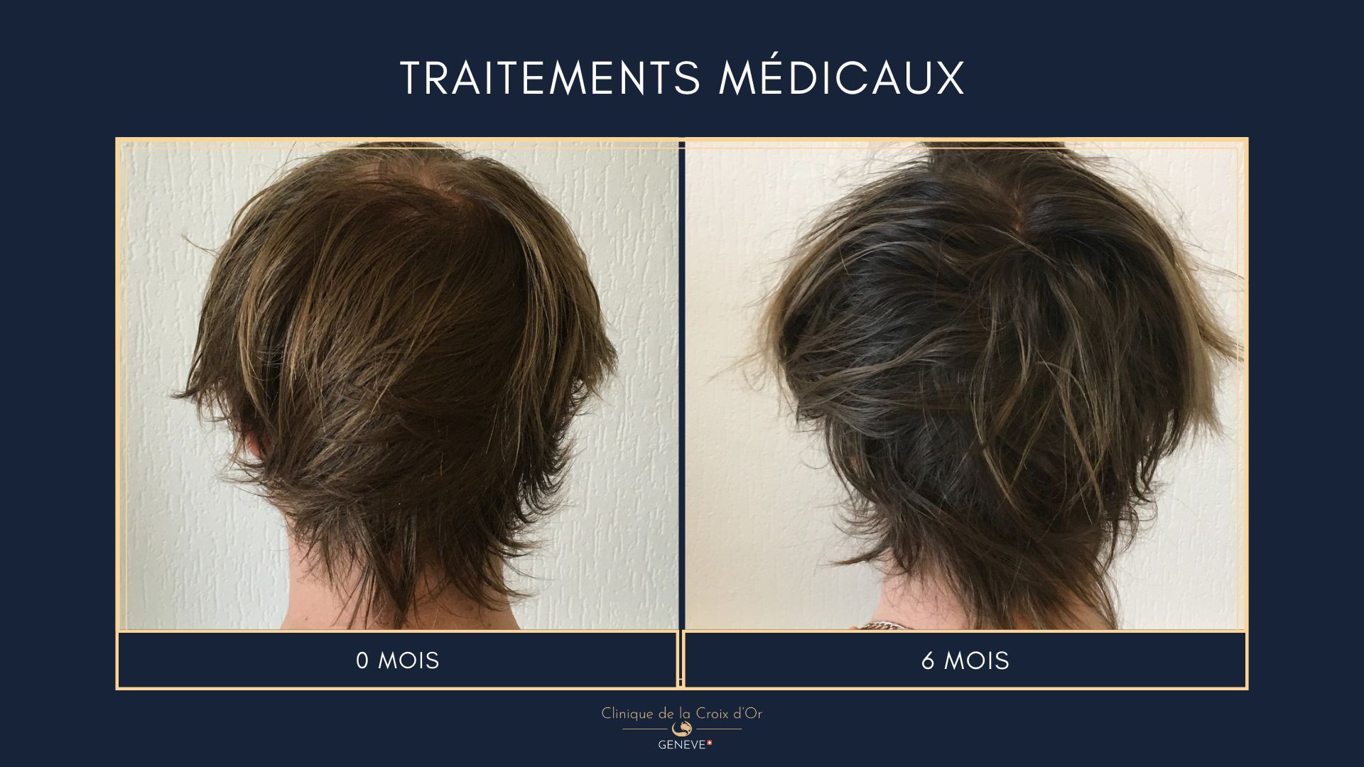 Medical treatments