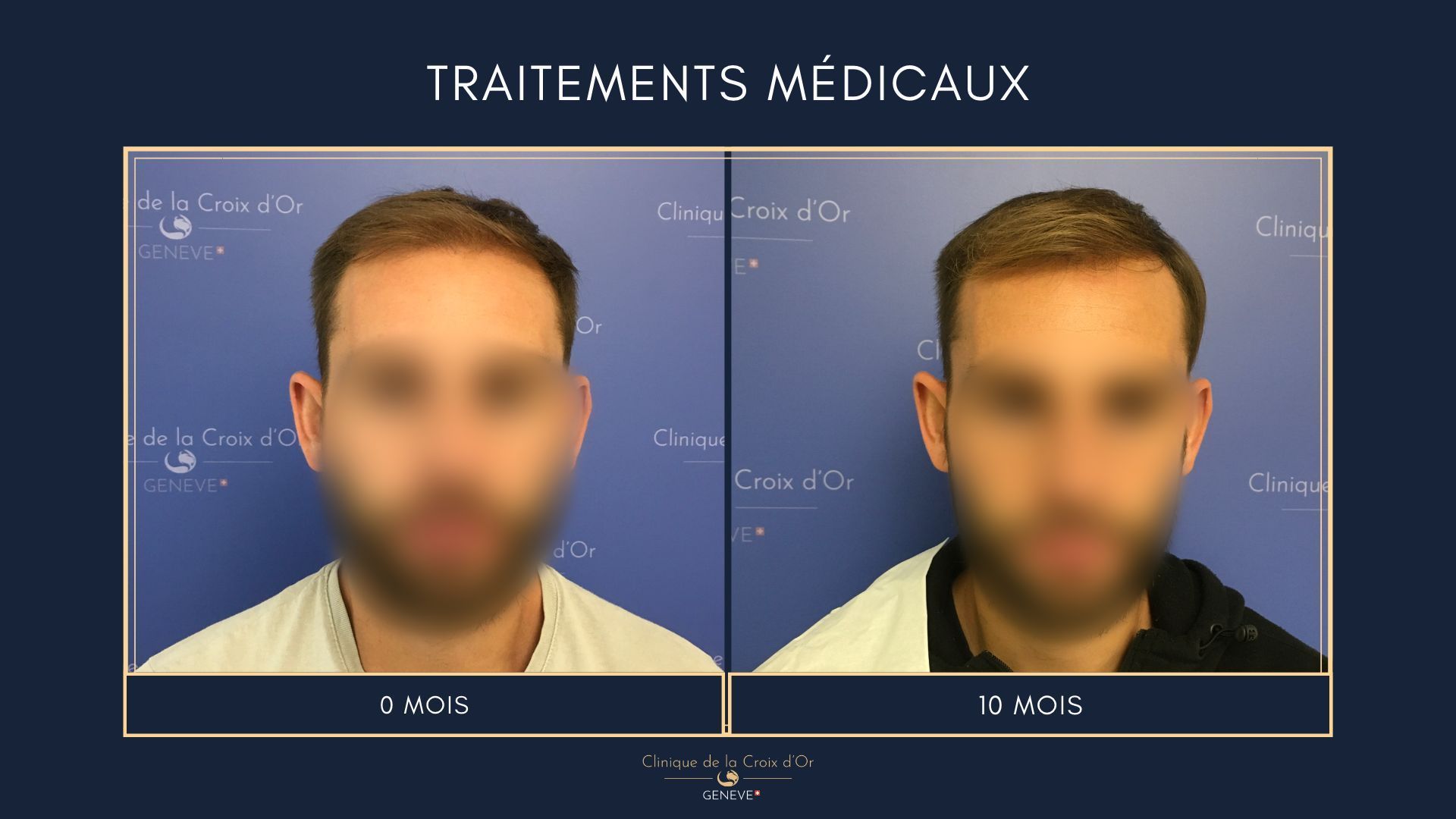 Medical treatments