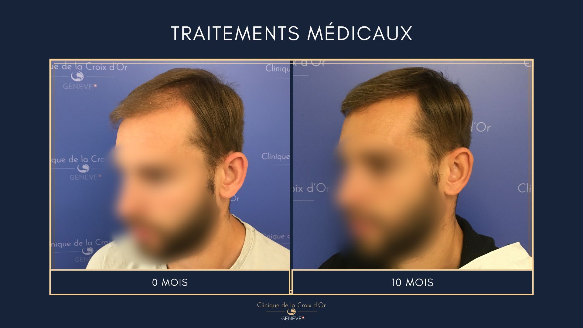 Medical treatments