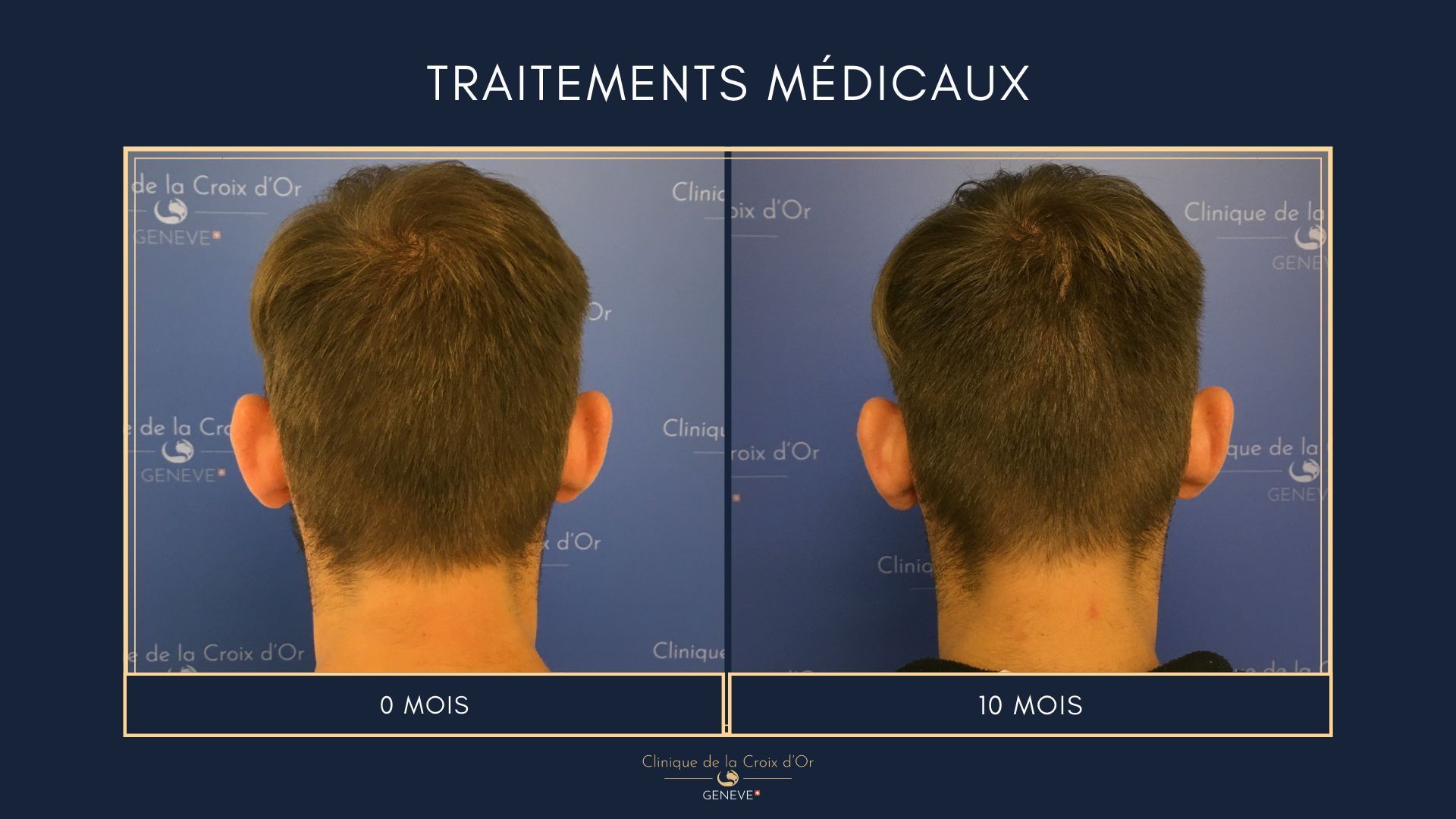 Medical treatments