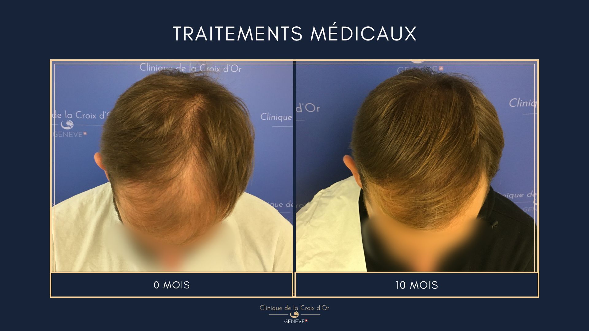 Medical treatments