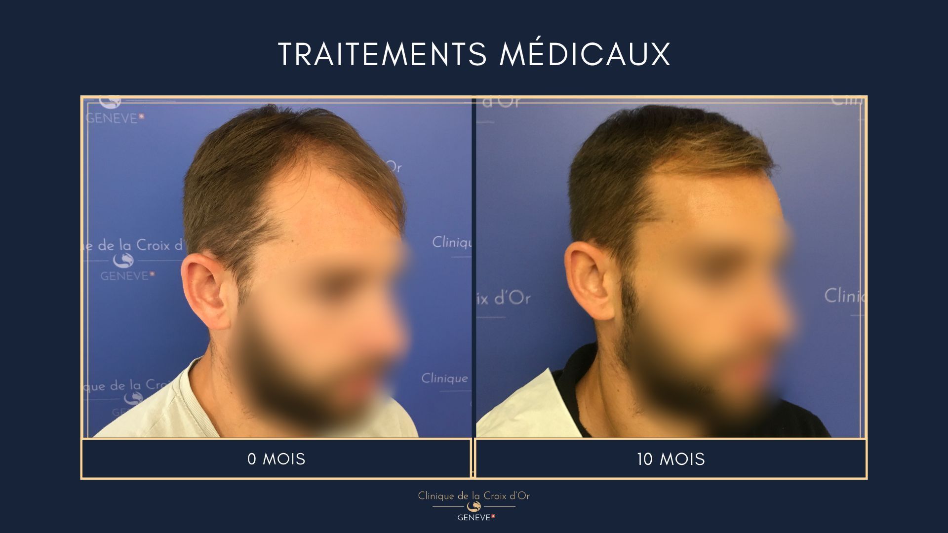 Medical treatments