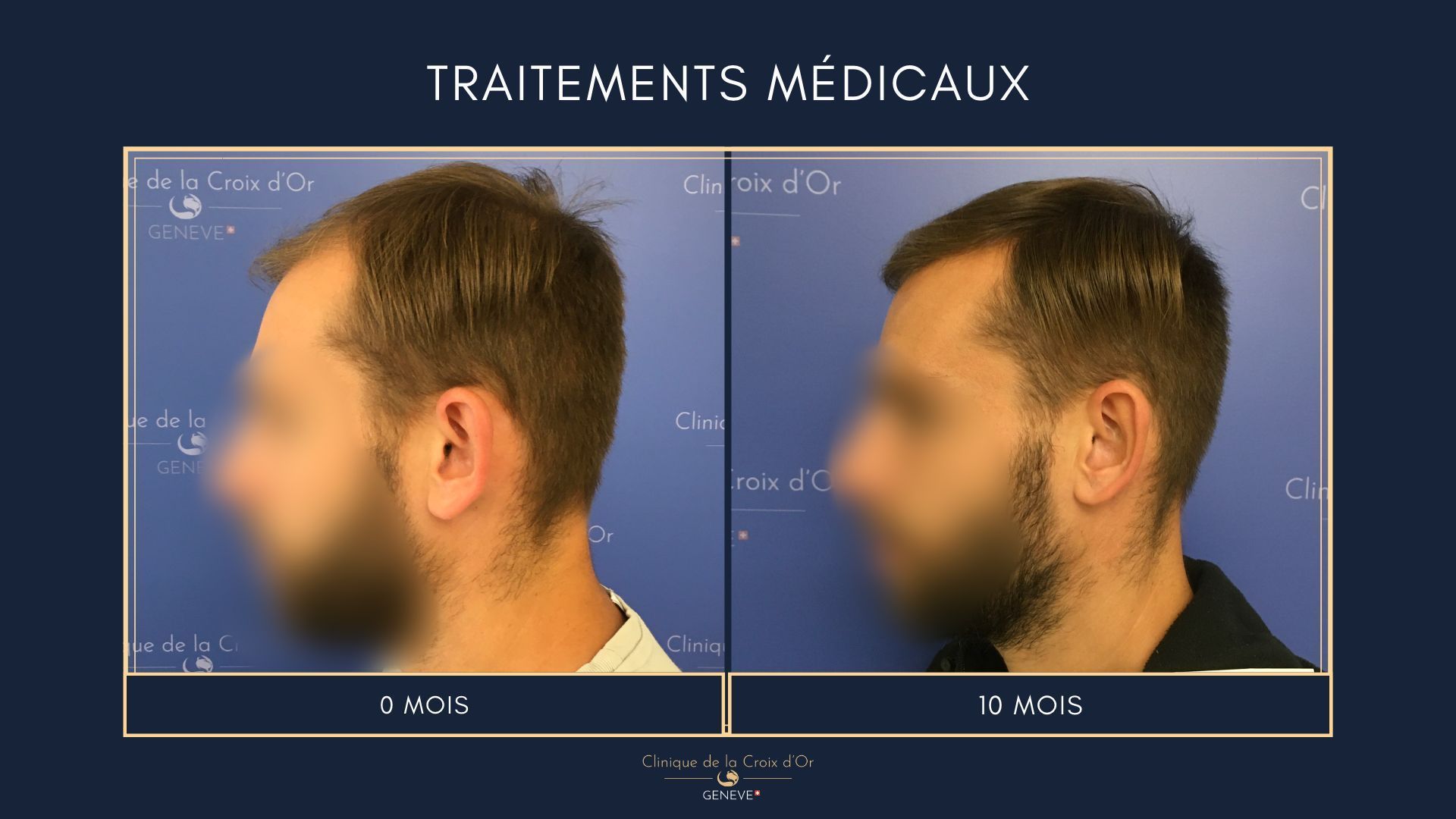 Medical treatments