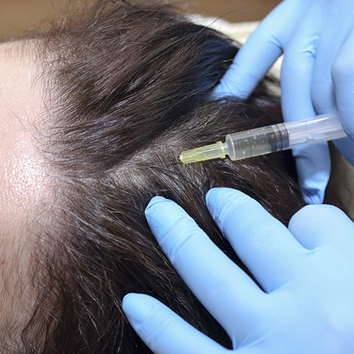 traitement mesotherapie anti chute de cheveux calvitie clinique croix or geneve suisse