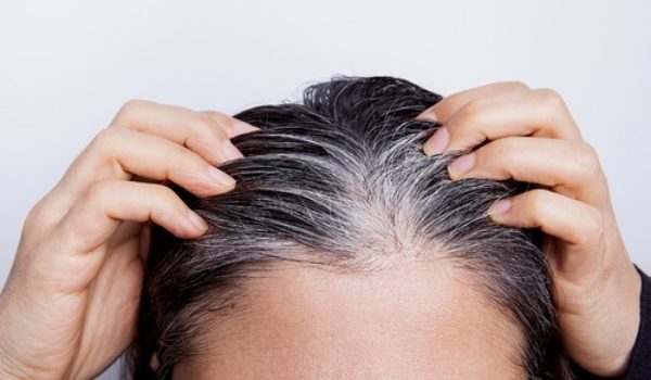 La perte de cheveux au moment de la ménopause, comment y remédier ?